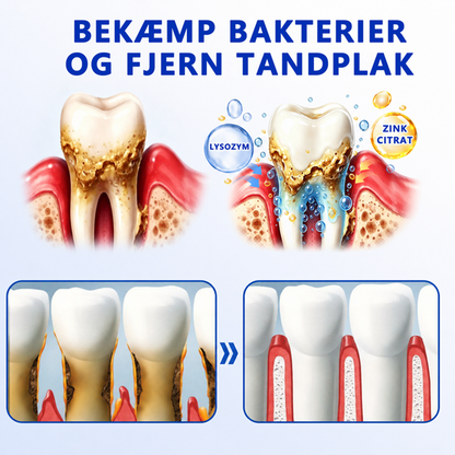 Choose the Gum-Care Plan That Fits Your Routine