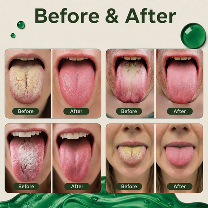 Anti-Bad Breath Herbal Gel Supplement by Nuvoriatt™