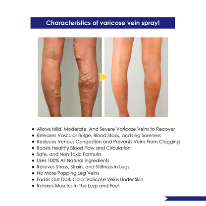 OUHOE® Varicose Vein Spray