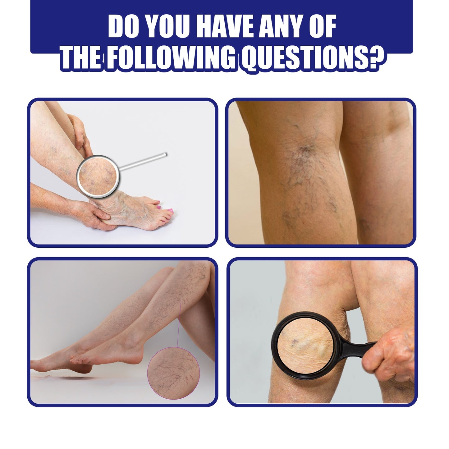 OUHOE® Varicose Vein Spray