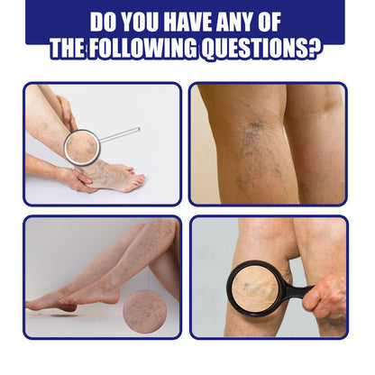 OUHOE® Varicose Vein Spray